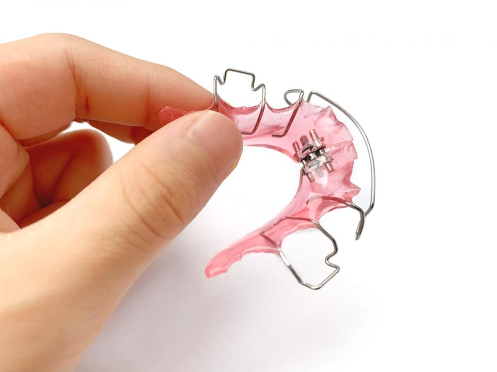 小児矯正-おすすめ - 小児矯正は北海道北広島市にある歯医者のさいわいデンタルクリニック札幌大曲