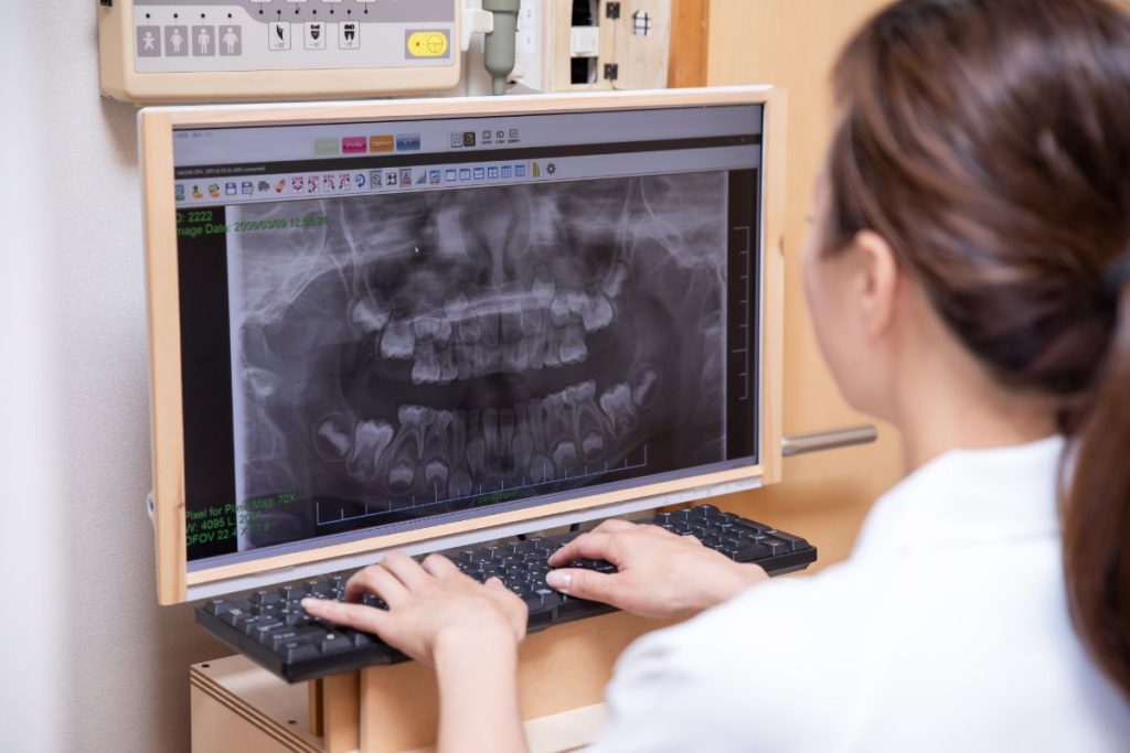 小児矯正-レントゲン - 小児矯正は北海道北広島市にある歯医者のさいわいデンタルクリニック札幌大曲