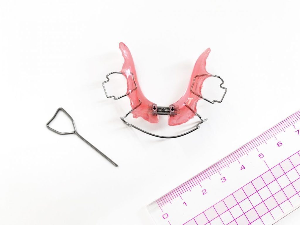 小児矯正-床矯正 - 小児矯正は北海道北広島市にある歯医者のさいわいデンタルクリニック札幌大曲