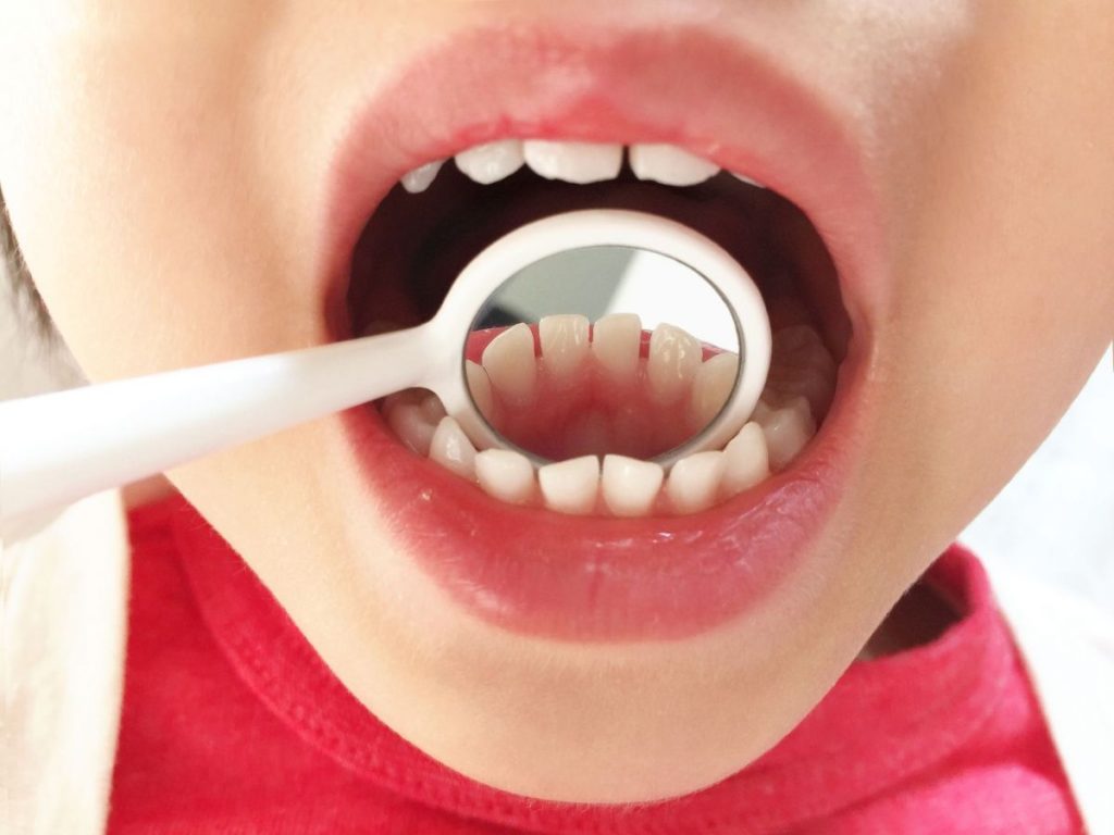 神楽岡駅-小児矯正-必要性 - 小児矯正は北海道北広島市にある歯医者のさいわいデンタルクリニック札幌大曲