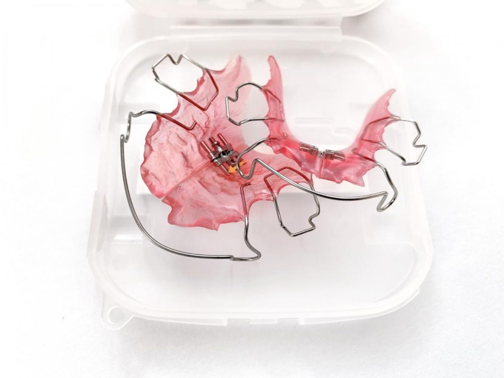 バンコク-小児矯正 - 小児矯正は北海道北広島市にある歯医者のさいわいデンタルクリニック札幌大曲