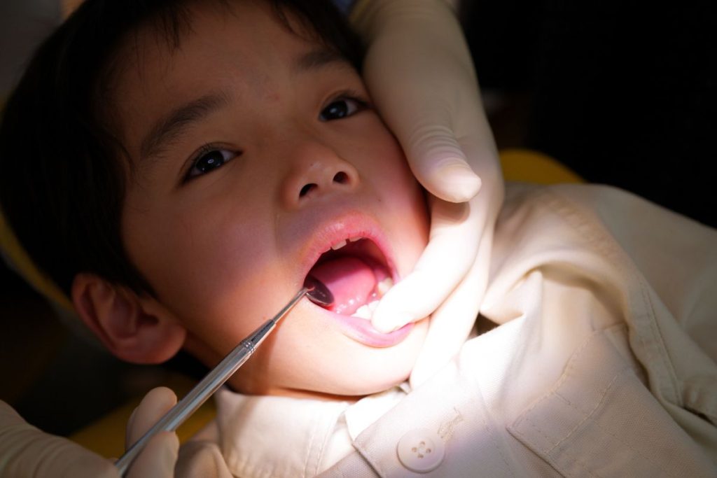 03小児矯正 マイオブレース - 小児矯正は北海道北広島市にある歯医者のさいわいデンタルクリニック札幌大曲