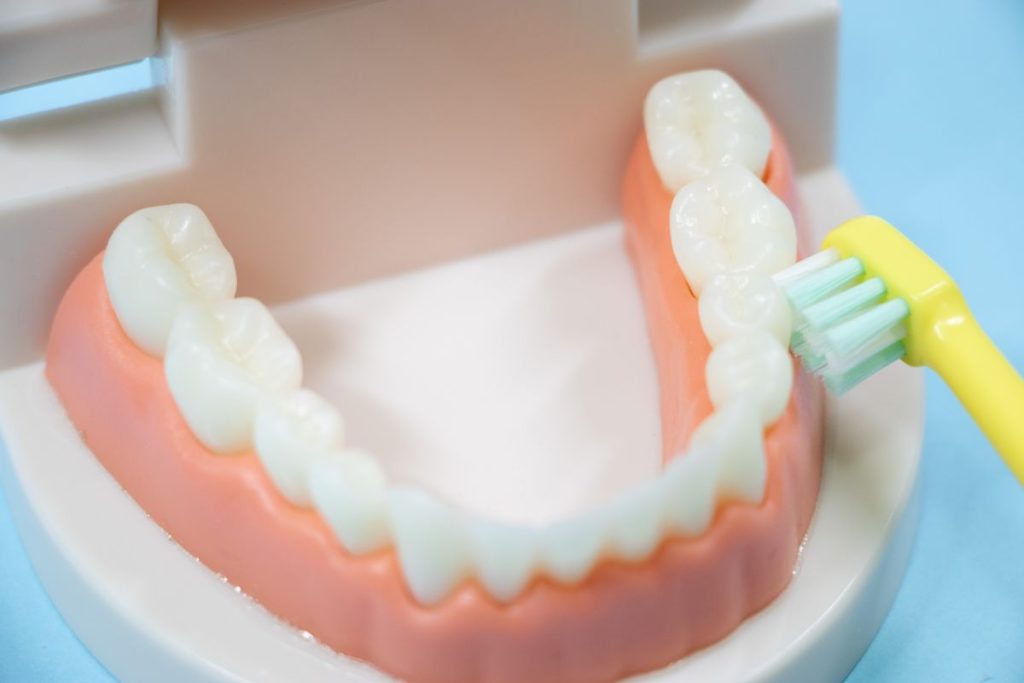 14小児歯科矯正 - 小児矯正は北海道北広島市にある歯医者のさいわいデンタルクリニック札幌大曲