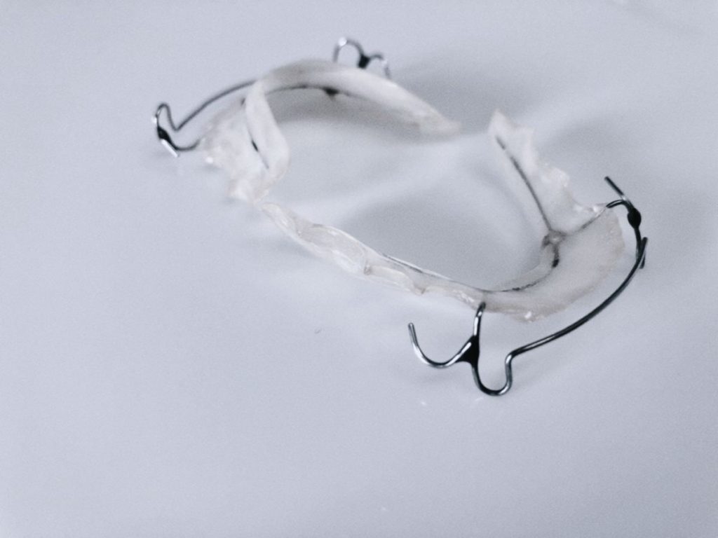 03小児矯正-マウスピース-ワイヤー - 小児矯正は北海道北広島市にある歯医者のさいわいデンタルクリニック札幌大曲