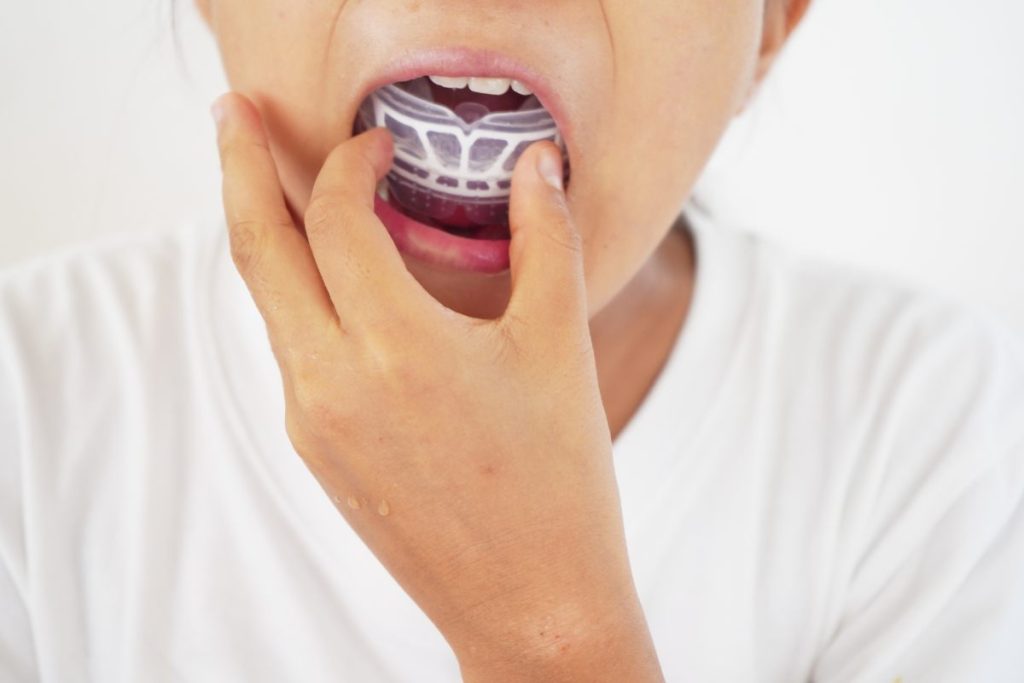 14小児矯正について - 小児矯正は北海道北広島市にある歯医者のさいわいデンタルクリニック札幌大曲