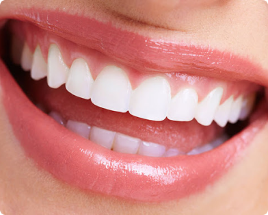 さいわいデンタルクリニック 歯垢のつきにくい長持ちするさし歯製作