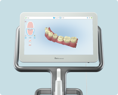 さいわいデンタルクリニック スキャンして型取りができるジルコニア治療