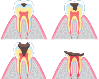 さいわいデンタルクリニック 治療した歯が痛い